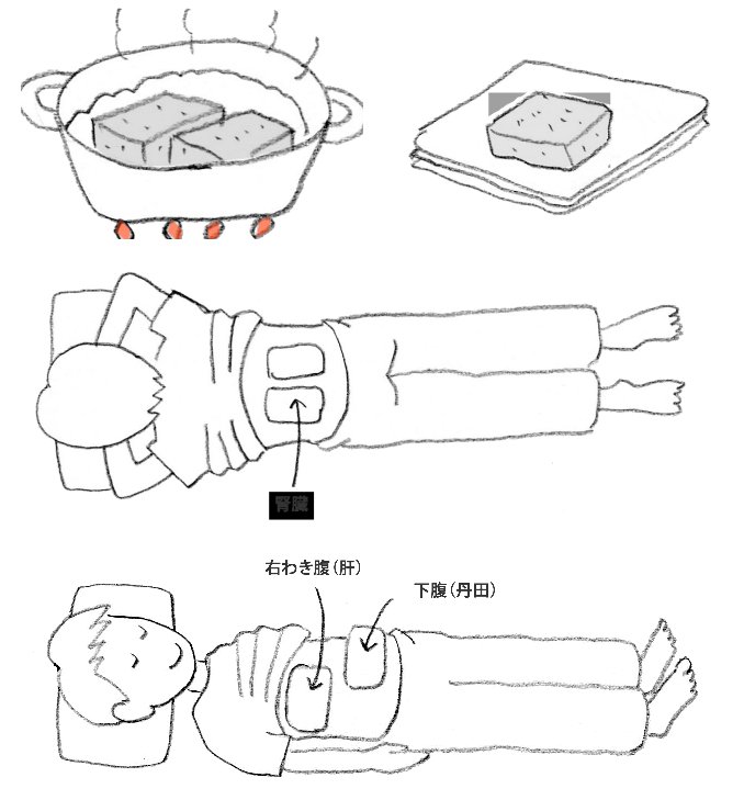 こんにゃく湿布