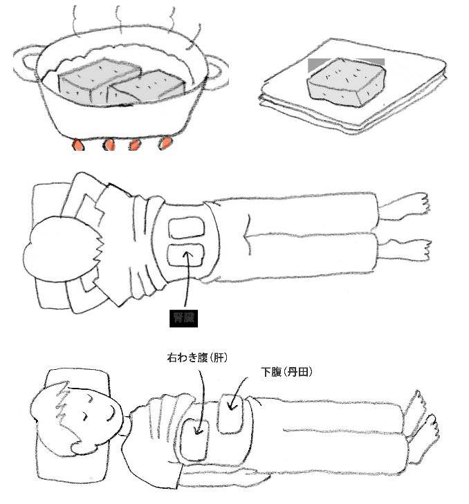 こんにゃく湿布